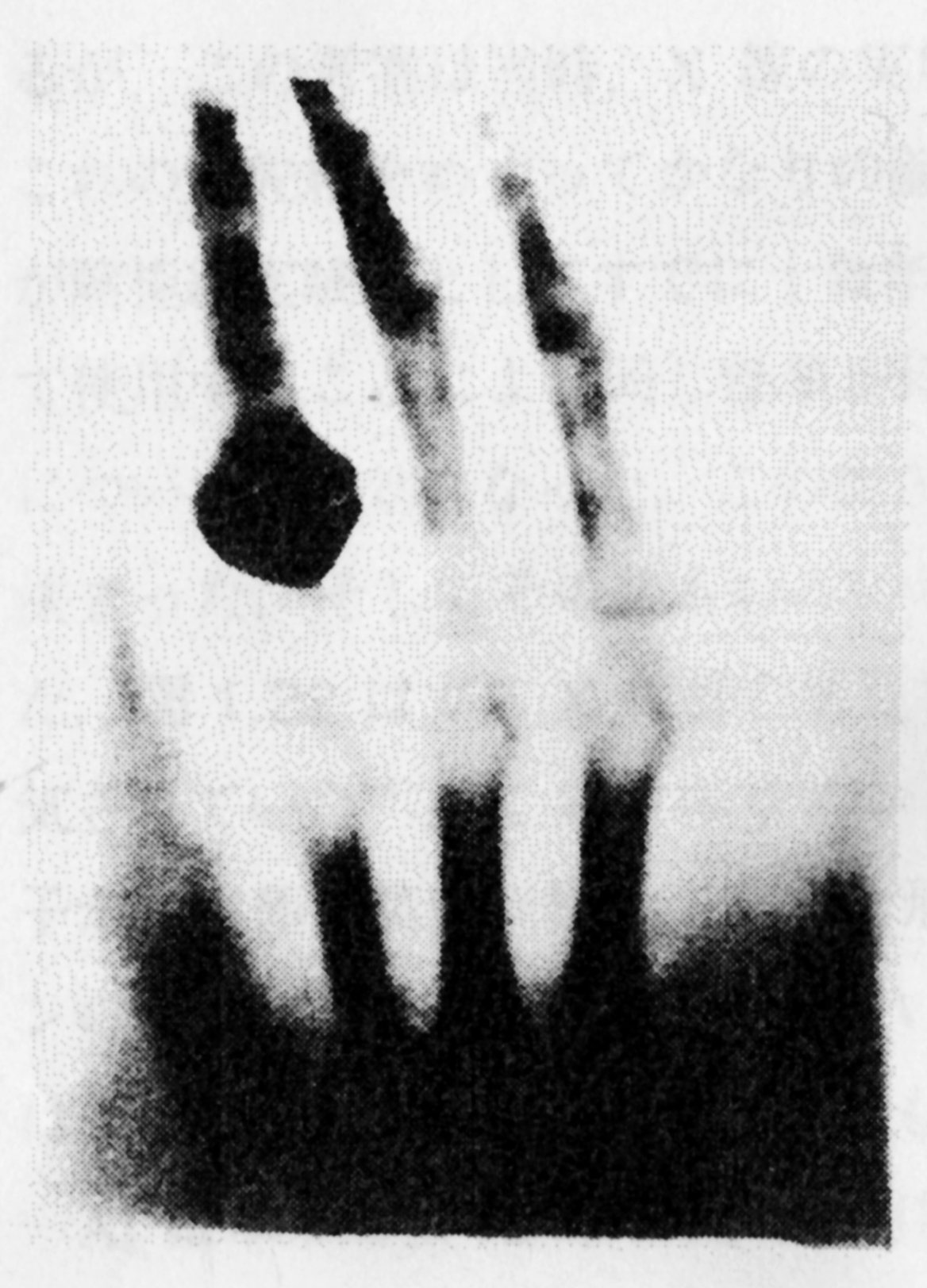図３．ベルタ婦人の手